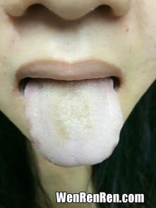 吃石榴舌头发黑是怎么回事,为什么吃了石榴以后舌头牙齿嘴巴